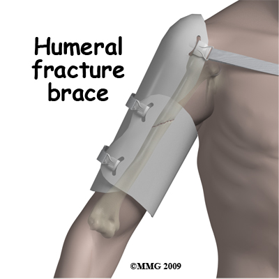humeral shaft
